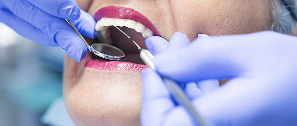 Best Emergency Wisdom Teeth Removal in Cottonwood, ID